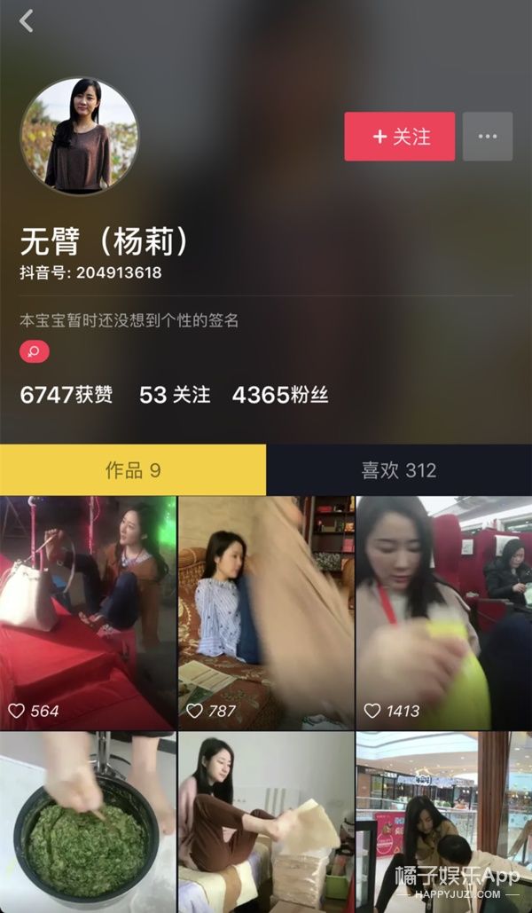 在直播平台里,杨莉遇到了很多"同病相怜"的小伙伴,比如下面这个独腿