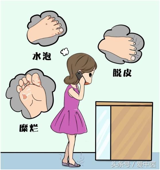 脚臭导致脚气,烂脚,奇痒无比!一个古方轻松帮你解决