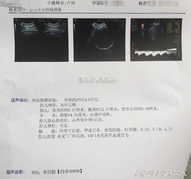 头胎男宝宝分享孕期肚型照及36周b超,好明显的男宝