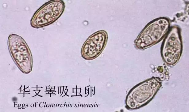 姑娘咳嗽老不好,一检查发现体内有虫!原来她最喜欢吃这些东西