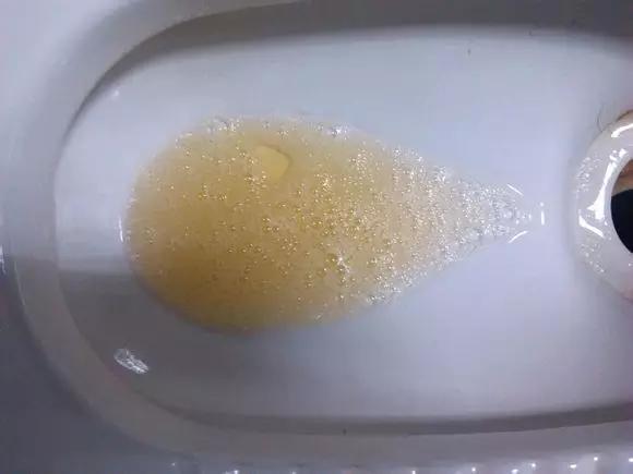小心惹上前列腺炎!
