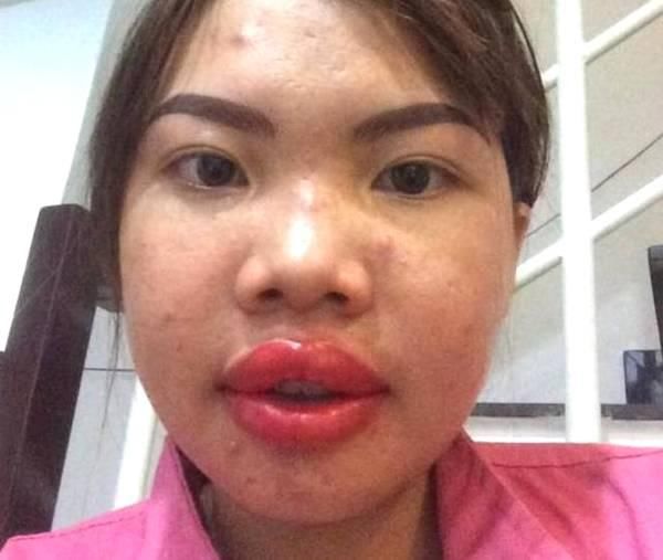 太丑没人娶,整容后从丑女逆袭成女神,成功嫁给了富二代!