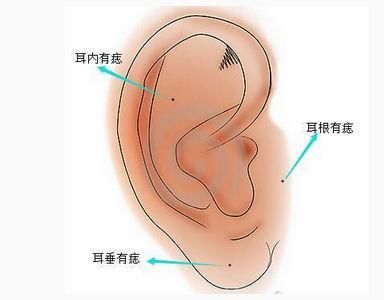 耳朵后面有痣好不好面相图片大全图搞笑动信微后面有痣图解1耳朵-北图片