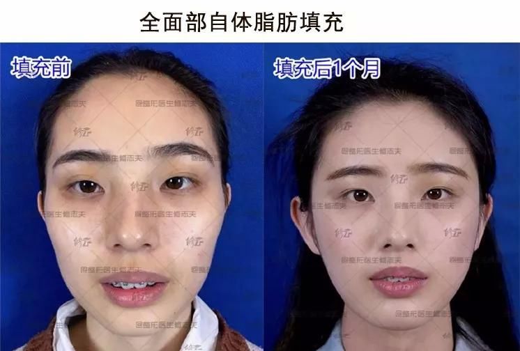 妇女节特辑:女人应该怎么抗衰老?