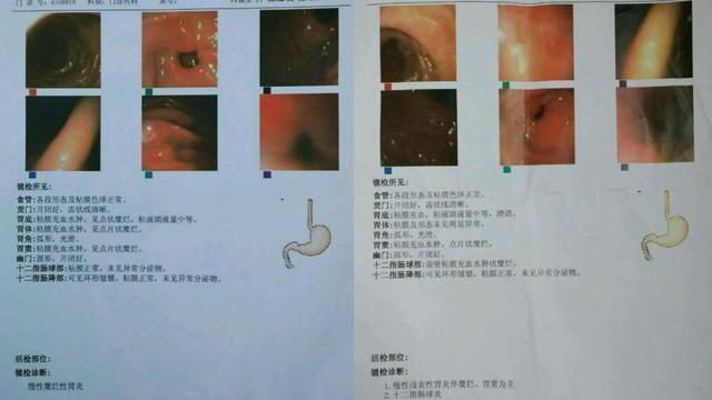 胃肠炎苦痛经历,请你对号入座,医生全面解析