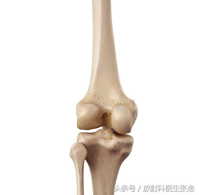 小腿的胫腓骨,还有前缘的髌骨,但是实际上膝关节的结构不仅仅有有这些