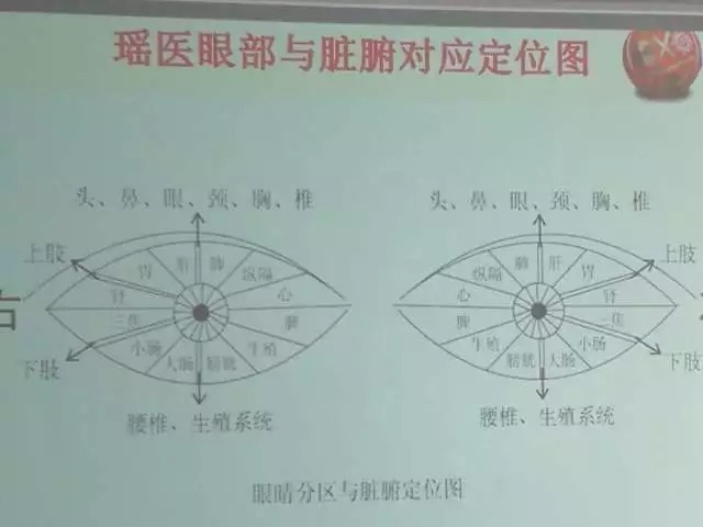 瑶医目诊是瑶医诊法中最有特色的诊法之一,它是通过观察眼睛来诊断