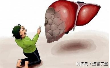肝硬化能活多久,权威专家给出答案