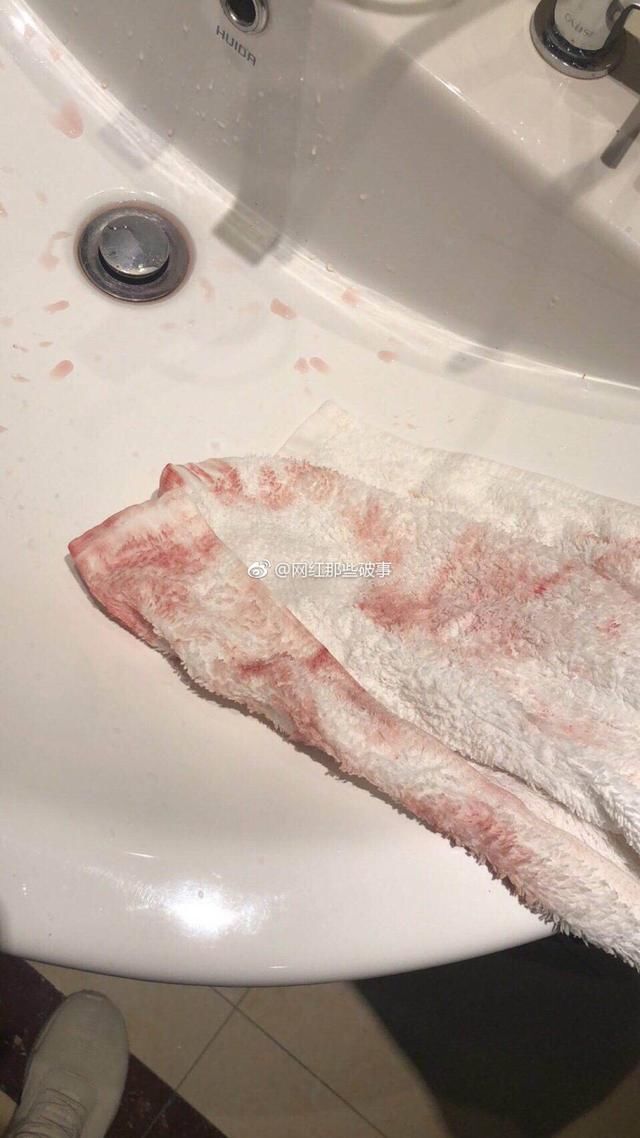 血沾满毛巾