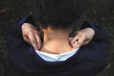 去年10月13日,延庆,在八达岭老虎咬人事件中受伤的赵菁(化名)首次