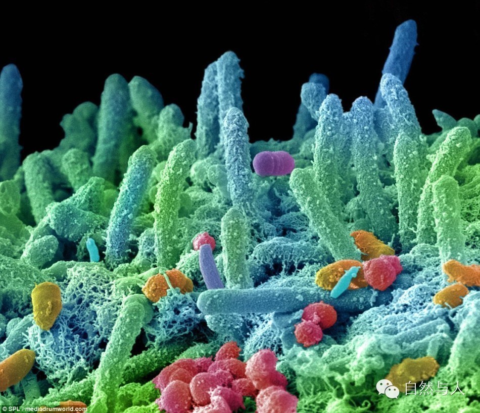 图中的细菌被放大了1万倍,还做了色彩处理.