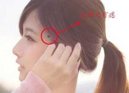 痣上长毛"一毛主孤,三毛主富",这个地方有痣的人天生