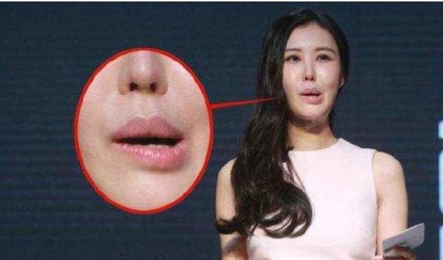 娱乐圈十大"歪嘴"女星, 郑爽柳岩可惜了!