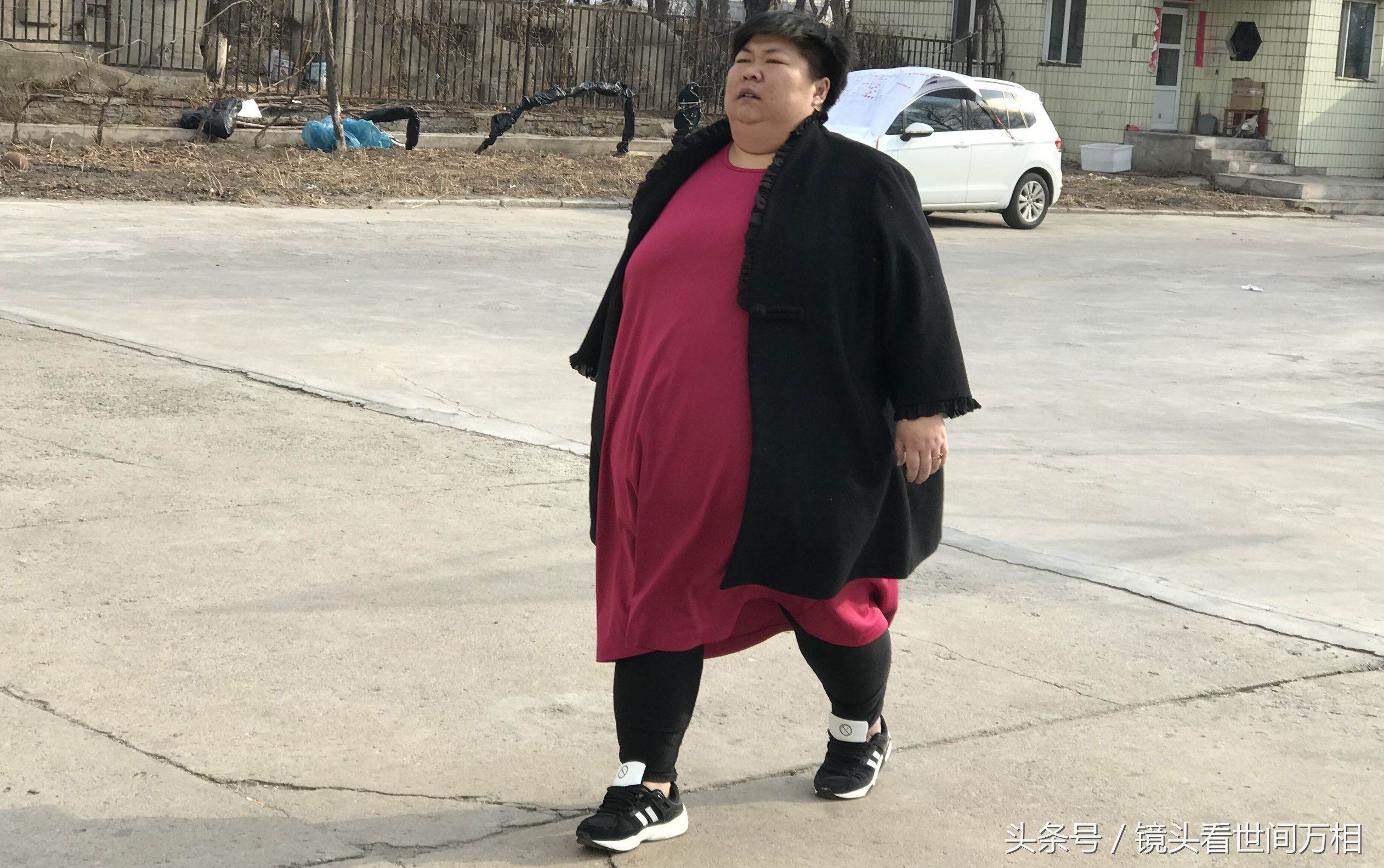 巨大的体重导致孙晓萍走路非常困难.