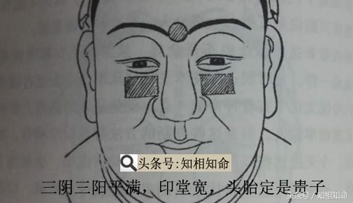 三阴三阳发暗枯,儿孙之路被截断. 若是阴阳上吊纹,后代子孙断香烟.