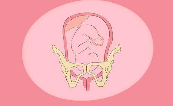 孕晚期,准妈妈有这3个特征,说明胎儿入盆了