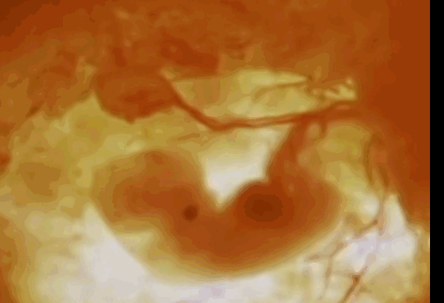 小编找到了十月宝宝变化的动态图,孕妈们快来看看吧~ 1个月的胎儿