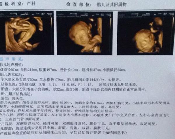 孕妈b超显示女宝,却生下男宝,女翻男成功,附症状,传男宝棒