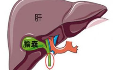 胆囊炎的常见信号,莫不可与胃病混淆!患有胆囊炎的都看看