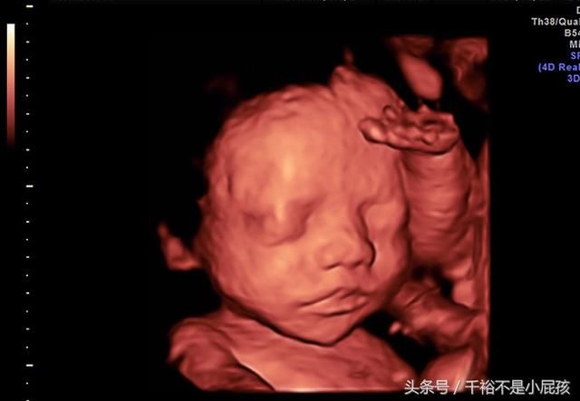 等怀孕到24周后,安婷去医院,做预约的四维彩超检查,那天她和婆婆一起