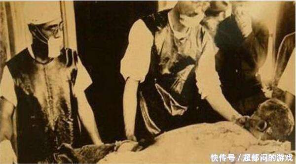 世界十大恐怖人体实验 简直不是人