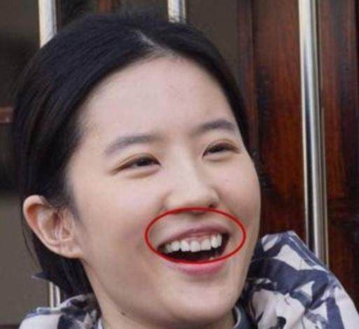 其实女神微微露齿笑每一张都能成为经典美照,然而,大笑起来就不一样了