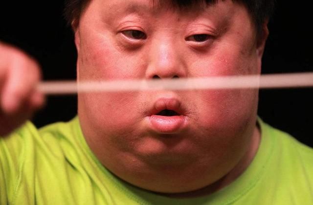 唐氏综合征患者又丑又笨?其实他们的世界很精彩