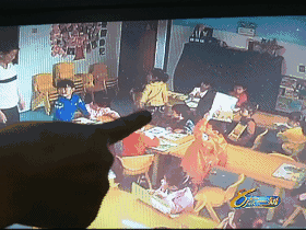 萍乡5岁幼儿练后翻腰导致