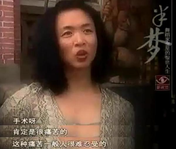 金星谈变性手术细节:医生操作失误差点毁我一生