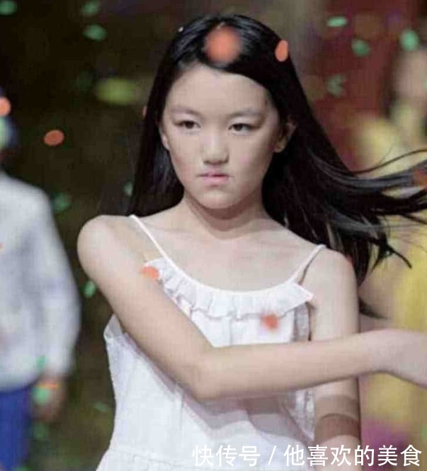 李嫣成功完成第三次手术,看不出兔唇痕迹,颜值开挂继承妈妈美貌