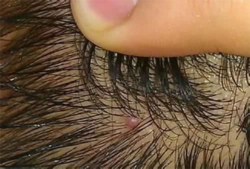 纷至沓来的意思