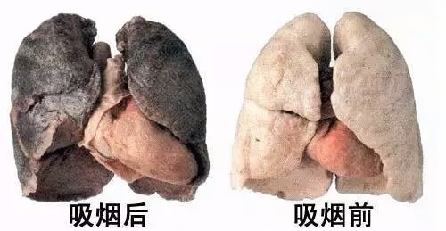         (图为吸烟前后肺脏对比)