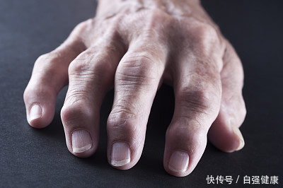 痛风发作,2个部位先有反应,治疗痛风很简单,从2个方面着手!