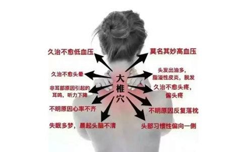 富贵包原理是什么_富贵包是什么