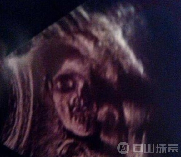 肚子里的婴儿竟朝母亲露出凶相,恐怖的样子吓坏