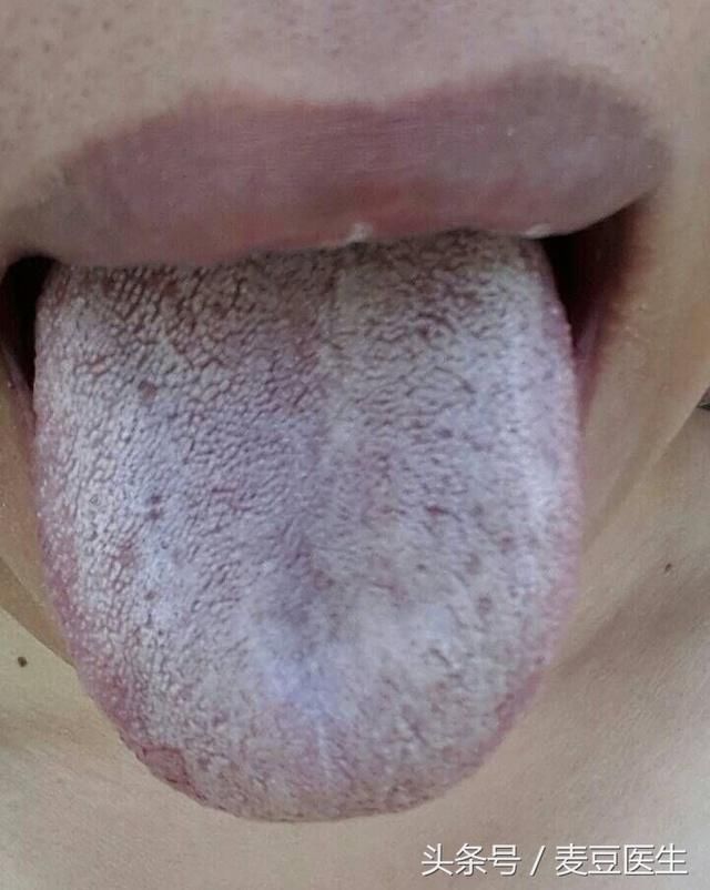 看舌头,知全身!