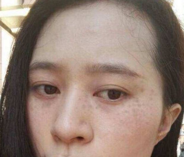 37岁姐姐巧用一"颗粒,仅是每天敷下脸,一月后顽固斑点,皱纹消失