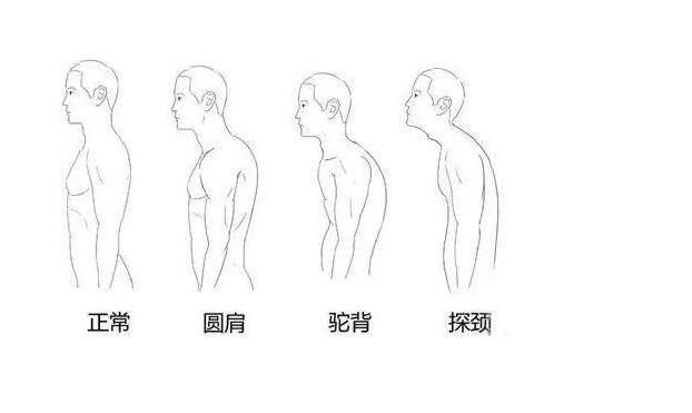 圆肩驼背的危害有这么多,4个动作改善圆肩驼背,助你挺