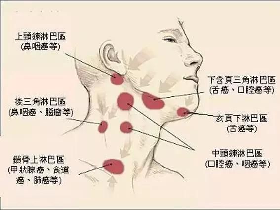 一发现便是中晚期,因为忽视了6大早期症状