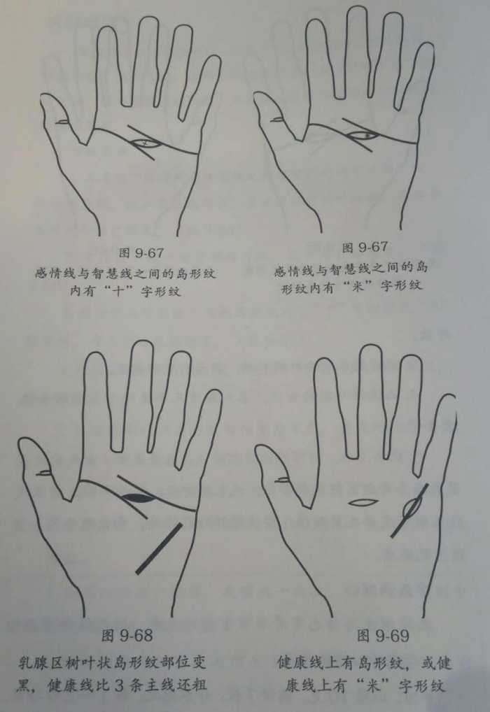 通过手居然能看出乳腺增生,比医院还准