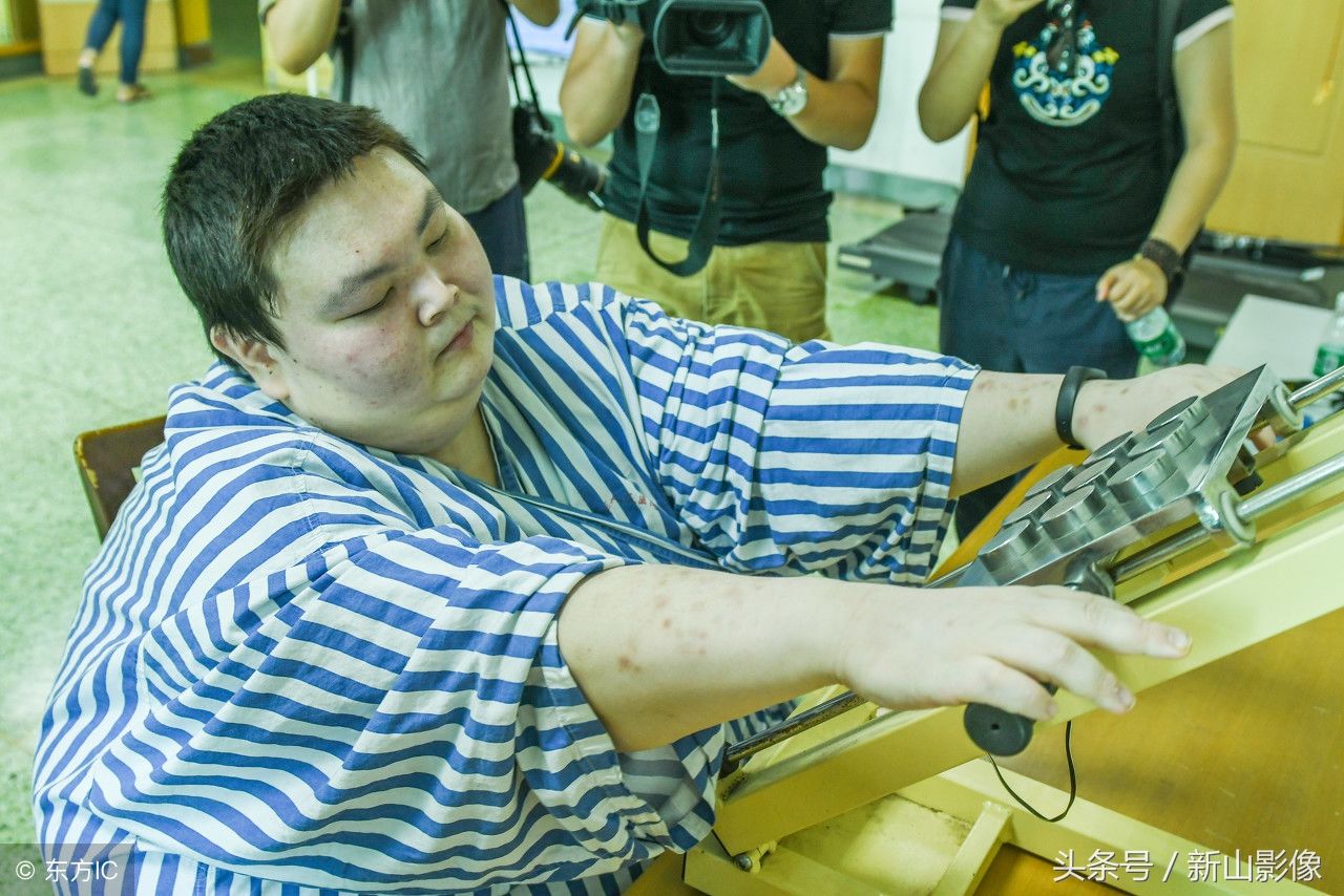 他医生术减肥a医生,胃被切掉80%,靠手称有望减减肥韩红图片