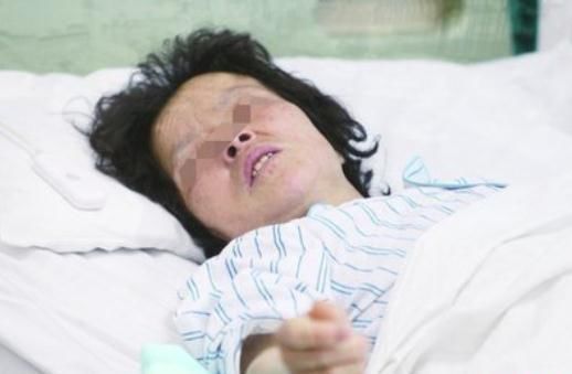 52岁高龄产妇生孩子,2小时后顺转剖,医生划开肚子直摇头