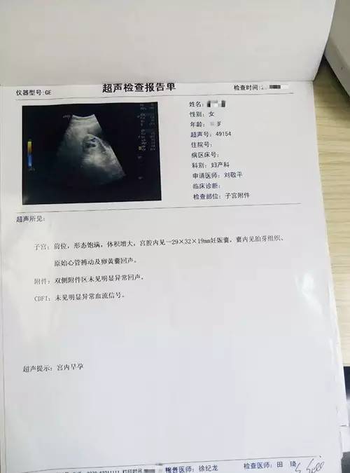 结婚7年6次流产,洛阳协和刘敬平主任妙手仁术送好孕