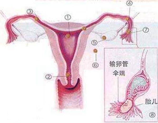 上环后的前三个月,子宫内组织发生变化,容易使经量增加,经期延长. 5.