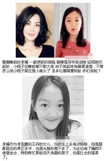 王菲女儿李嫣手术成功颜值康复,李嫣:拜托别再说我丑了我变美了