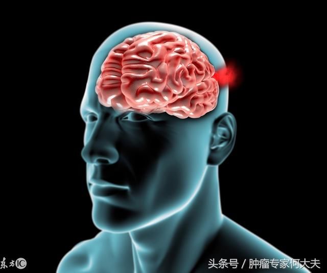 25%~40%的颅外恶性肿瘤在病程中将发生脑转移.