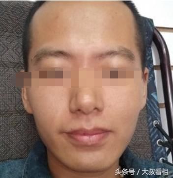 "苦命"的面相特征,这辈子必定一穷二白,怕是难发大财!