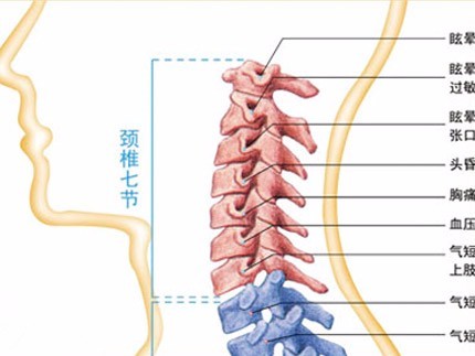 临床医学基础知识:关于颈椎病