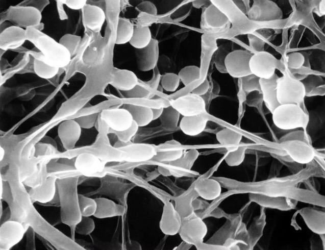 在显微镜下皮癣真菌的菌丝结构.