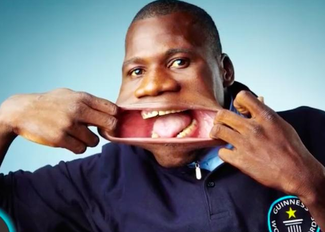 24岁的斯托夫是世界上最长舌头,吉尼斯世界记录保持者,从他嘴的边缘到